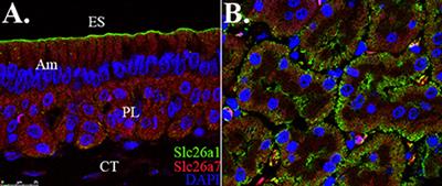 Deletion of Slc26a1 and Slc26a7 Delays Enamel Mineralization in Mice